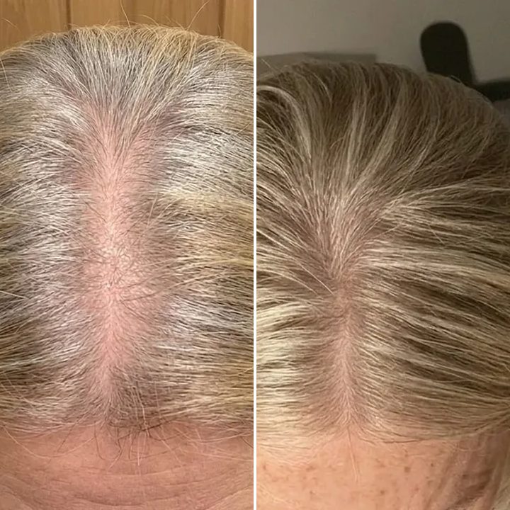 Nicola B., before and after