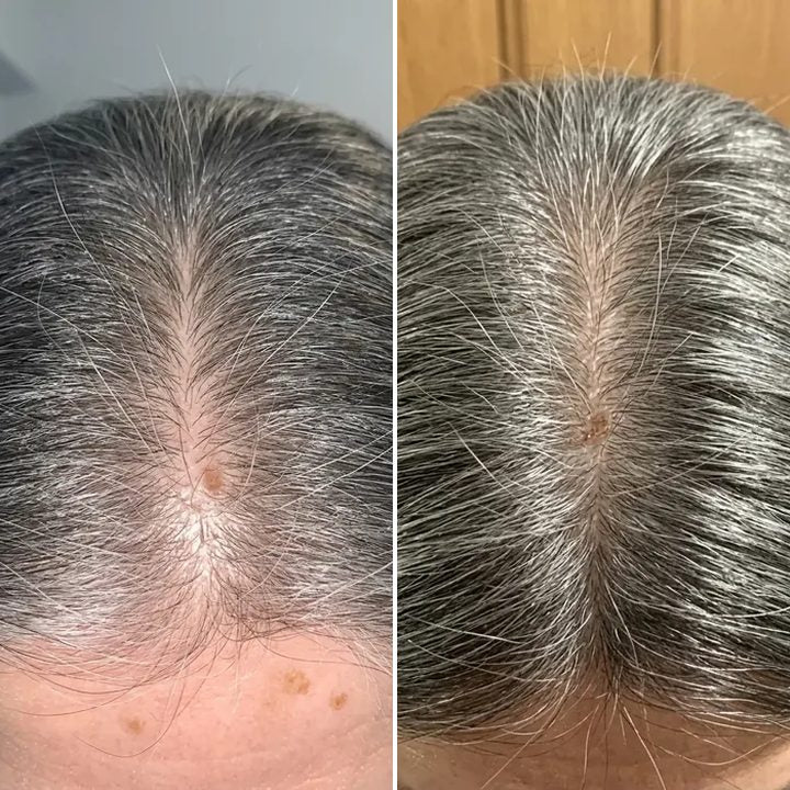 Margaret T., before and after