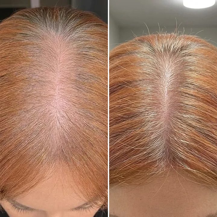 Julie L., before and after
