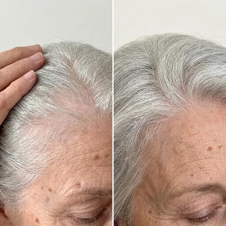 Emily C., before and after