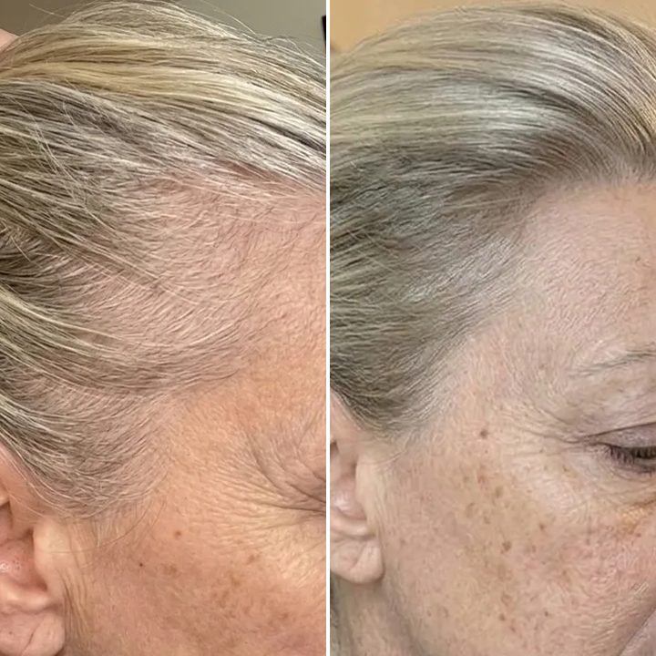 Hannah R., before and after