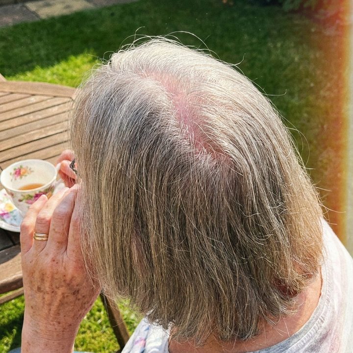 Sun on the crown of a woman at a garden table