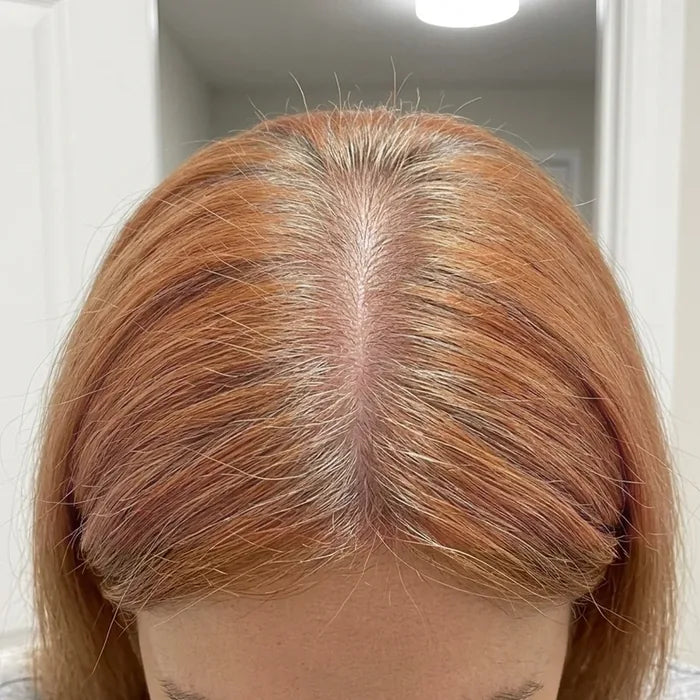 After