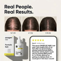 formula no5 hair growth serum
