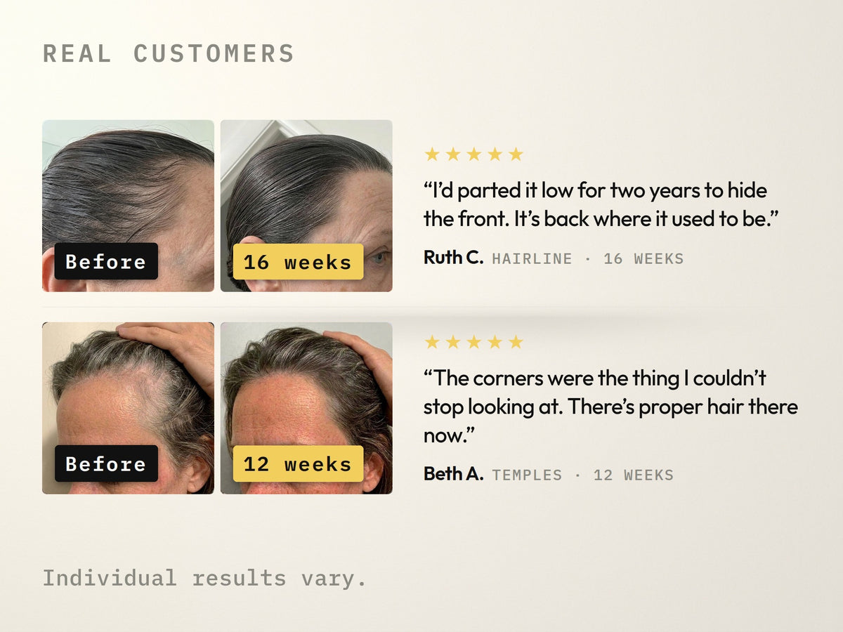 formula no5 hair growth serum