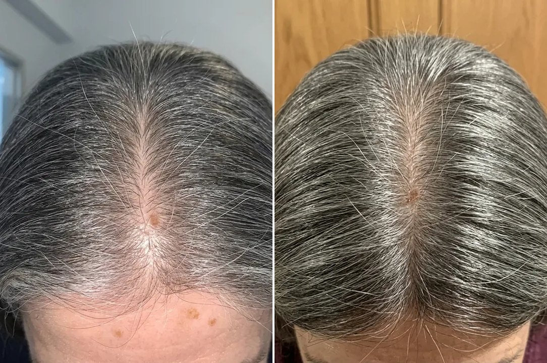 Margaret T.'s parting before and after 16 weeks