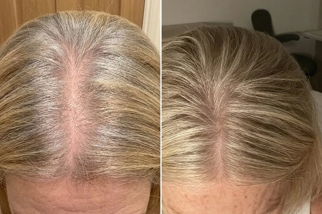 Nicola B.'s parting before and after 16 weeks