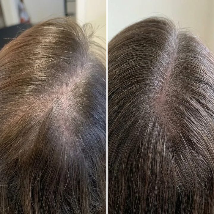 Laura B., before and after, 20 weeks