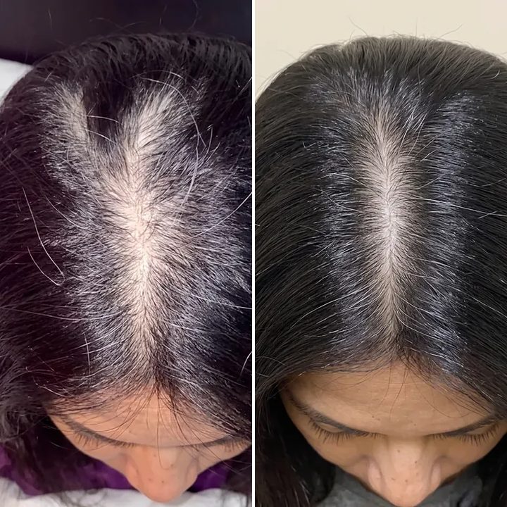 Priya S., before and after