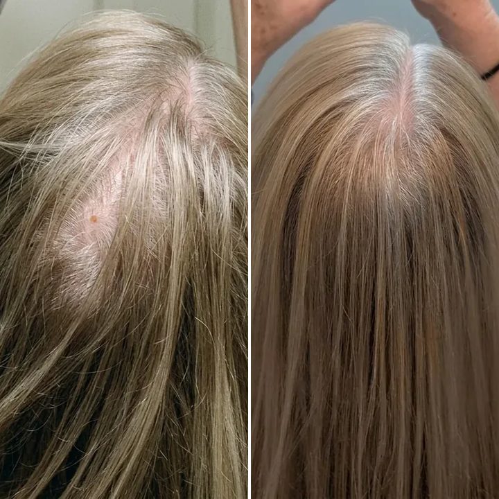 Fiona W., before and after