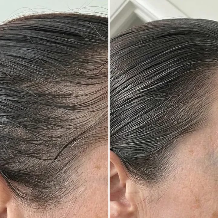 Ruth C., before and after