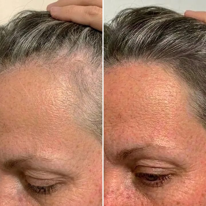 Beth A., before and after